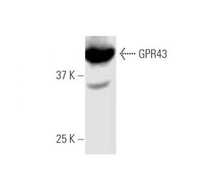 GPR43 Antibody (3B3) - Western Blotting - Image 347556SAM Transcription Activation: SAM system utilizing dCas9-VP64, MS2-P65-HSF1, and sgRNA for precise gene transcription activation.