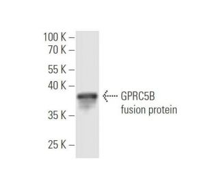 GPRC5B Antibody (1H1) - Western Blotting - Image 349583