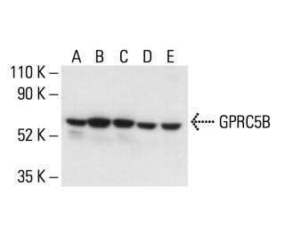 GPRC5B Antibody (A-8) - Western Blotting - Image 404948Each CRISPR/Cas9 Knockout (KO) Plasmid product consists of a pool of 3 plasmids designed to ensure identification and cleavage of a specific gene for maximum knockout efficiency. Each plasmid encodes a unique 20 nt sequence derived from the GeCKO (v2) library. 