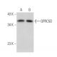 GPRC5D Antibody (E-2) - Western Blotting - Image 360048