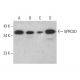 GPRC5D Antibody (E-2) - Western Blotting - Image 377045 