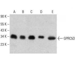 GPRC5D Antibody (E-2) - Western Blotting - Image 386851