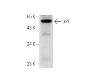 GPT Antibody (B-1) - Western Blotting - Image 304954 