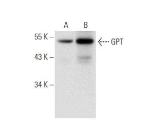 GPT Antibody (E-3) - Western Blotting - Image 304956 