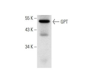 GPT Antibody (E-4) - Western Blotting - Image 304955 