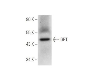 GPT Antibody (G-9) - Western Blotting - Image 304953 