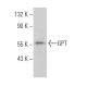 GPT Antibody (G-9) - Western Blotting - Image 363993