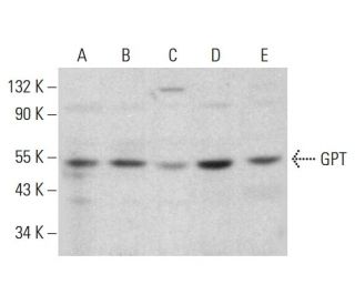 GPT Antibody (E-3) - Western Blotting - Image 383125