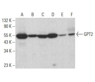 GPT2 Antibody (G-7) - Western Blotting - Image 385287 