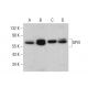 このポリクローナル抗体は販売終了となりました。弊社推奨の<a href="gpvi-antibody-h-5">GPVI (H-5)</a>モノクローナル抗体をご覧ください(サンプルデータを表示)。 western blotting image from recommended GPVI (H-5) monoclonal antibody replacement. Image 382090