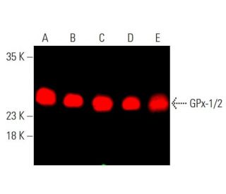glutathione peroxidase antibody santa cruz Anti-Glutathione 4 [EPNCIR144] - BSA and Azide free (ab219592) It is present in the glandular epithelium of human endometrium. Anti-Glutathione Peroxidase 1 antibody (ab22604)