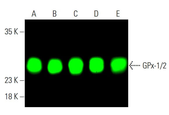 glutathione peroxidase 1 antibody Association of Glutathione S-transferase Gene Polymorphisms With  Hepatocellular Carcinoma in Patients From Maharashtra, India main image 1