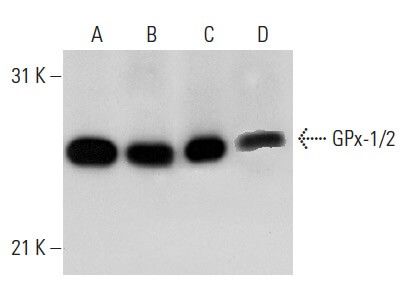 gscpr glutathione Schematic representation of the structure of a Glutathione