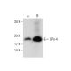 Glutathione Peroxidase 4/GPX4 Antibody (D-3) - Western Blotting - Image 73161 