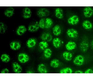 Kページ Glutathione Peroxidase 4/GPX4抗体(E-12) | SCBT - Santa Cruz