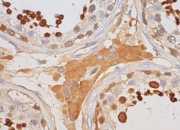 2SC3240/20個 Glutathione Peroxidase 4/GPX4 Antibody (E-12) | SCBT