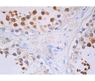 Glutathione Peroxidase 4/GPX4 Antibody (E-12) | SCBT - Santa