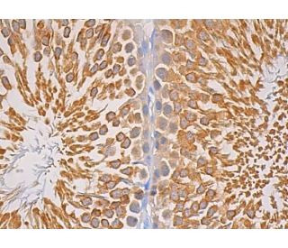 Glutathione Peroxidase 4/GPX4 Antibody (E-12) | SCBT - Santa