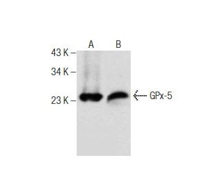 Glutathione Peroxidase 5/GPX5 Antibody (D-2) - Western Blotting - Image 160868