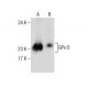 Glutathione Peroxidase 5/GPX5 Antibody (G-1) - Western Blotting - Image 286043