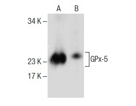 Glutathione Peroxidase 5/GPX5 Antibody (G-1) | SCBT - Santa