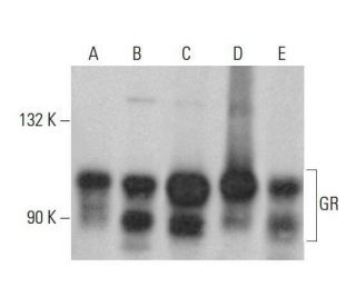 western blotting image from recommended GR/NR3C1/Glucocorticoid Receptor (G-5) monoclonal antibody replacement. Image 352031