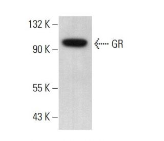 GR/NR3C1/Glucocorticoid Receptor Antibody (F-10) - Western Blotting - Image 377730 