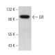 GR/NR3C1/Glucocorticoid Receptor Antibody (F-10) - Western Blotting - Image 377730 