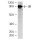 GR/NR3C1/Glucocorticoid Receptor Antibody (FiGR) - Western Blotting - Image 1611 