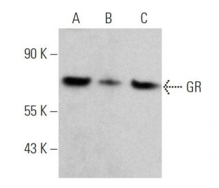 GR/NR3C1/Glucocorticoid Receptor Antibody (FiGR) - Western Blotting - Image 360391 