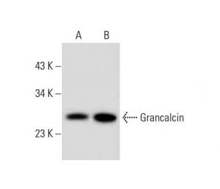 Grancalcin Antibody (F-12) - Western Blotting - Image 298005 
