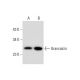 Grancalcin Antibody (F-12) - Western Blotting - Image 298005 