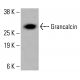 Anticuerpo Ac-Histona H4 (B-10): sc-515319. Análisis por Western blot de la expresión de Ac-Histona H4 en lisados celulares completos de HCT-116 sin tratar (A) y tratados químicamente (B, C, D). β-Actina (C4): sc-47778 utilizado como control de carga. Reactivo de detección utilizado: m-IgG Fc BP-HRP: sc-525409. Grancalcin Antibody (G-12) - Western Blotting - Image 415996