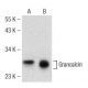 Grancalcin Antibody (H-7) - Western Blotting - Image 147357 