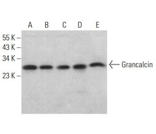 Grancalcin Antibody (H-7) - Western Blotting - Image 381348 