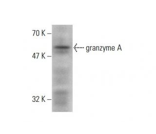 granzyme A Antibody (3G8.5) - Western Blotting - Image 138659Each CRISPR/Cas9 Knockout (KO) Plasmid product consists of a pool of 3 plasmids designed to ensure identification and cleavage of a specific gene for maximum knockout efficiency. Each plasmid encodes a unique 20 nt sequence derived from the GeCKO (v2) library.