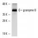 这种多克隆抗体已经停产。请参阅我们推荐的<a href="granzyme-b-antibody-2c5">granzyme B (2C5)</a>单克隆抗体(显示样本数据)。 western blotting image from recommended granzyme B (2C5) monoclonal antibody replacement. Image 234