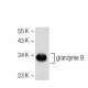 granzyme B Antibody (GB7) - Western Blotting - Image 41093 
