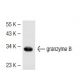 granzyme B Antibody (GRB7) - Western Blotting - Image 41092 