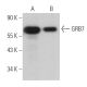 Este anticuerpo policlonal ha dejado de fabricarse. Consulta nuestro anticuerpo monoclonal recomendado <a href="grb7-antibody-a-12">GRB7 (A-12)</a> (se muestran datos de muestra). western blotting image from recommended GRB7 (A-12) monoclonal antibody replacement. Image 363810