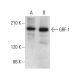 GRF-1 Antibody (C-4) - Western Blotting - Image 381111 