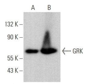 GRK 1 Antibody (D11) - Western Blotting - Image 379404 