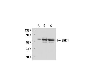 GRK 1 Antibody (D11) - Western Blotting - Image 15621Each CRISPR/Cas9 Knockout (KO) Plasmid product consists of a pool of 3 plasmids designed to ensure identification and cleavage of a specific gene for maximum knockout efficiency. Each plasmid encodes a unique 20 nt sequence derived from the GeCKO (v2) library.