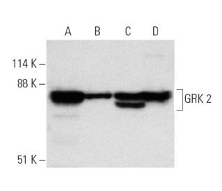 western blotting image from recommended GRK 2 (C-9) monoclonal antibody replacement. Image 7107