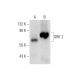 GRK 2 Antibody (E-7) - Western Blotting - Image 70512 