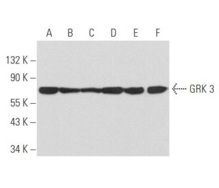 western blotting image from recommended GRK 3 (C-11) monoclonal antibody replacement. Image 357477