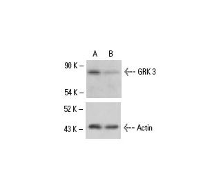 GRK 3 siRNA (h): sc-35514. Western blot analysis of GRK 3 expression in non-transfected control (A) and GRK 3 siRNA transf 