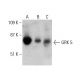 western blotting image from recommended GRK 5 (D-9) monoclonal antibody replacement. Image 385346
