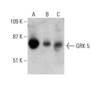 western blotting image from recommended GRK 5 (D-9) monoclonal antibody replacement. Image 385346