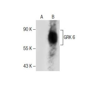 western blotting image from recommended GRK 6 (D-10) monoclonal antibody replacement. Image 285050
